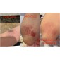 Băng Dán Vết Thương Band-Aid Advanced Healing Hydro Seal Jumbo 3 Miếng – Bảo Vệ & Hỗ Trợ Phục Hồi Vết Thương