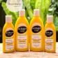 Dầu gội giảm gàu, nấm đầu Selsun Anti-Dandruff Treatment Shampoo